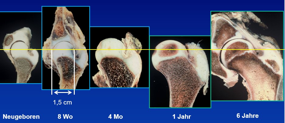 Hüftentwicklung nach der Geburt